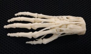 3D printed hand model for teaching, diagnosis, procedural planning. Digital file is a VA resource, hospitals can request models 3D printed on network printers for shipment. (Photo: Business Wire)