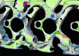 Volkswagen Foundry Uses 3D Laser Scanning for Part Inspection