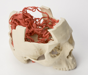 Z Corp’s 3D Printed Models Aid Surgical Procedures